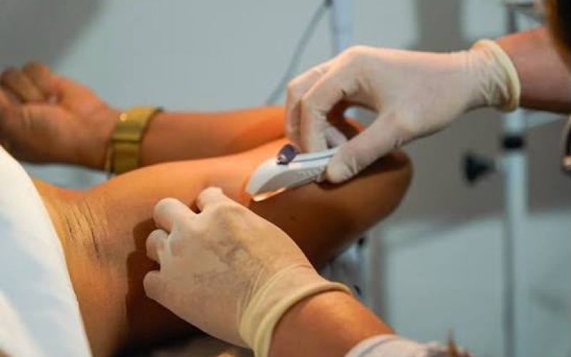 Implanon no SUS em Goiás: saiba como funciona e quem pode ter acesso